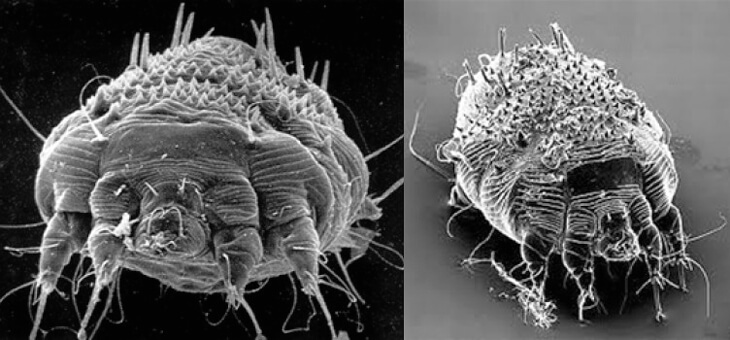 Самка чесоточного клеща под микроскопом.